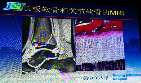 https://mmbiz.qpic.cn/mmbiz_png/un3IibyVC5Ya9EBuXZdhECibnxXZ7Z5DCHLKm5kpRYca2aQqsj0Pozzh7YhxR4Dic2GT0iak3ViboPxcwiapmwNGGQ0A/640?wx_fmt=png